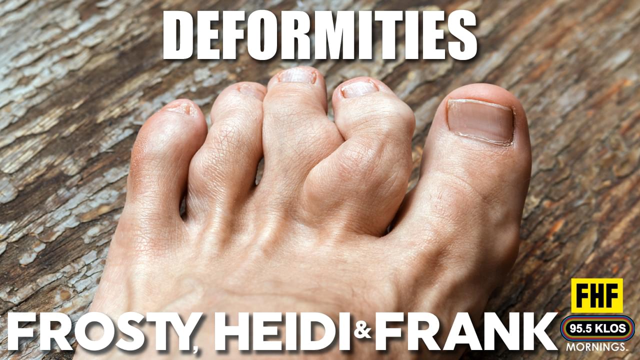 Deformities