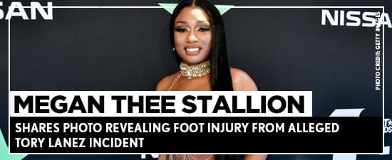 Megan Thee Stallion Shares Photo Revealing Foot Injury From Alleged Tory Lanez Incident