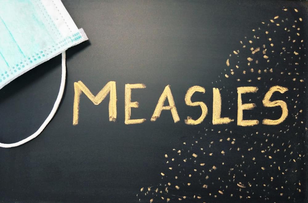 Measles Outbreak Has Reached a High of 695 Cases Across 22 States