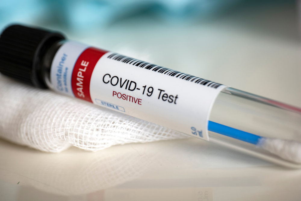 Website to order free Covid-19 tests is up and running