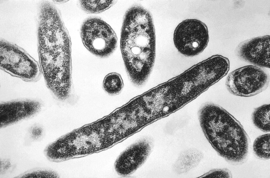 19 diagnosed with Legionnaires’ Disease in Bronx; 1 death