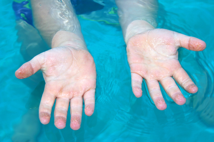 MUNDANE MYSTERIES: Why do our fingers get wrinkly when swimming?