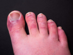Melissa In The Morning: Covid Toes?!?!