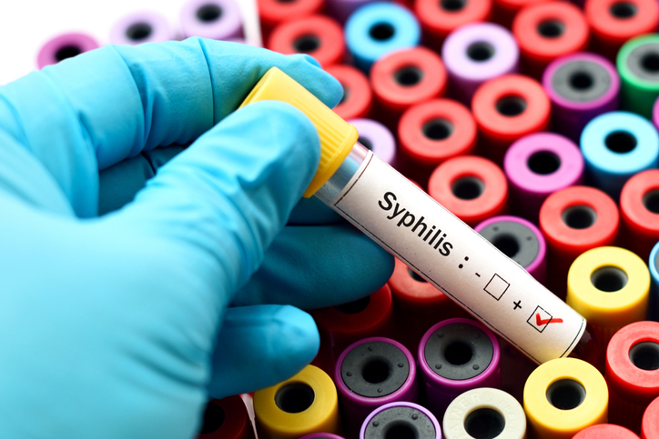 Melissa in the Morning: A Syphilis Resurgence