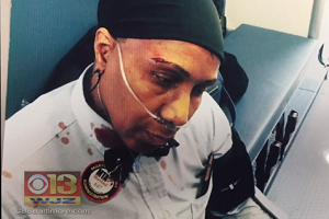 MTA Bus Driver Beaten And Bloodied While Shocked Passengers Watch