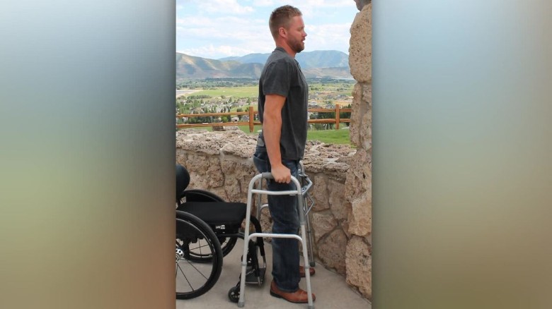 Paralyzed men stand again thanks to electrical stimulators