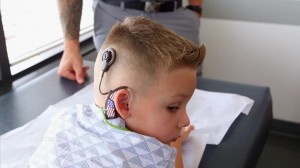 Next generation hearing implants for kids