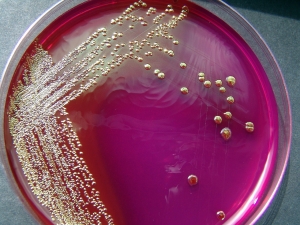 escherichia-coli