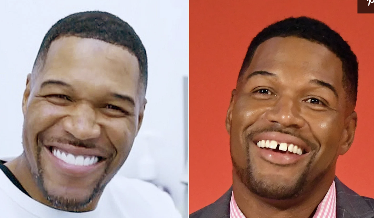 Michael Strahan Reveals His Teeth ‘Gap Is Here to Stay’ in April Fool’s Day Prank