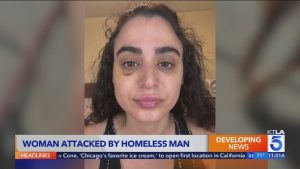 Woman Says Homeless Man Attacked Her as She Walked Her Dog