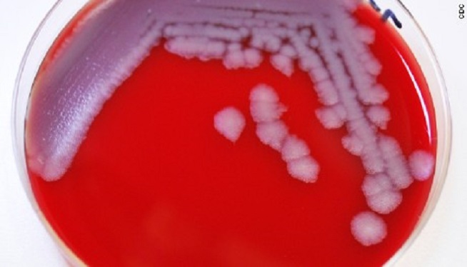 WATCH: 51 labs in 17 States with Questionable Anthrax