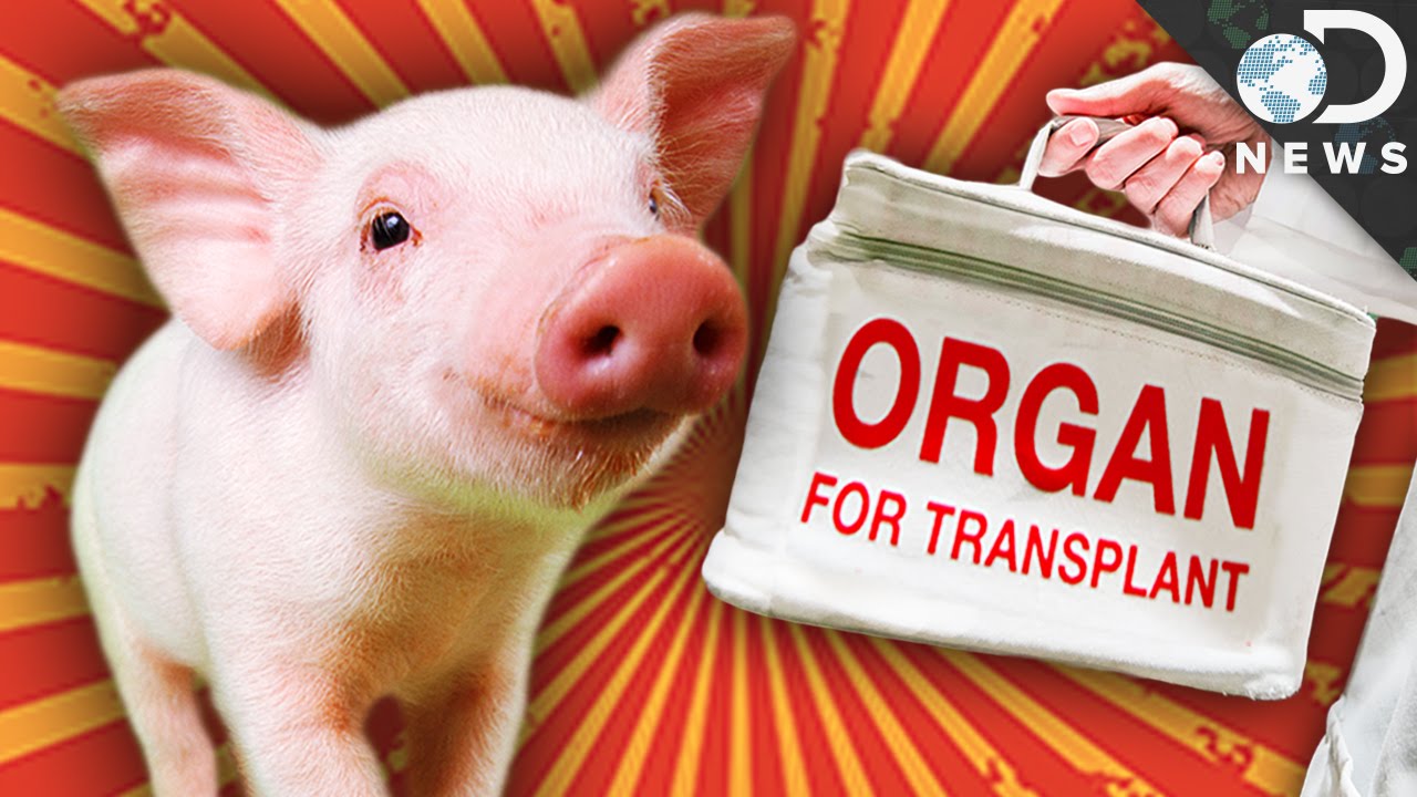 In 1st, US surgeons transplant pig heart into human patient