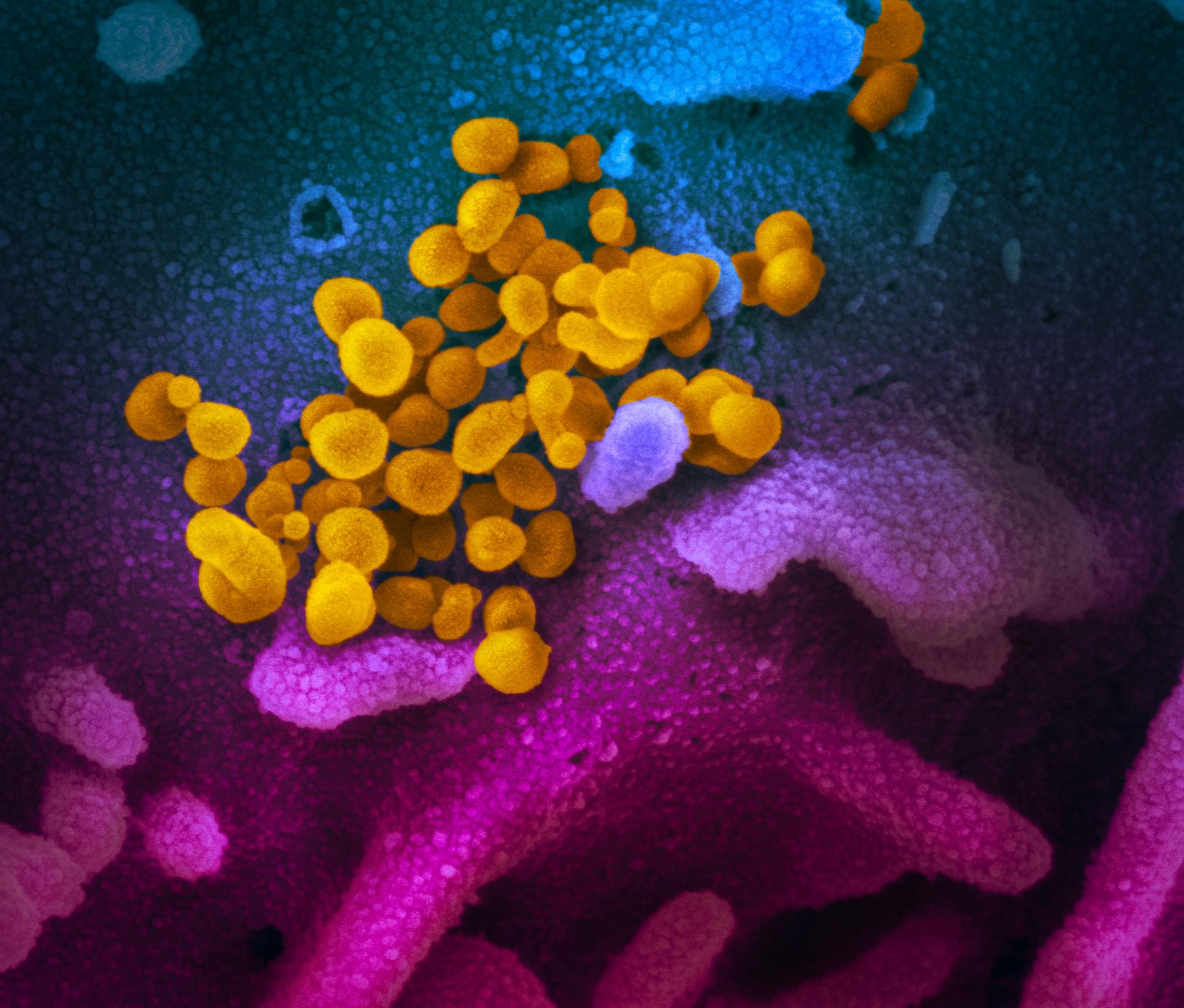 WBAP Morning News: What Should We Do To Protect Ourselves from COVID-19?