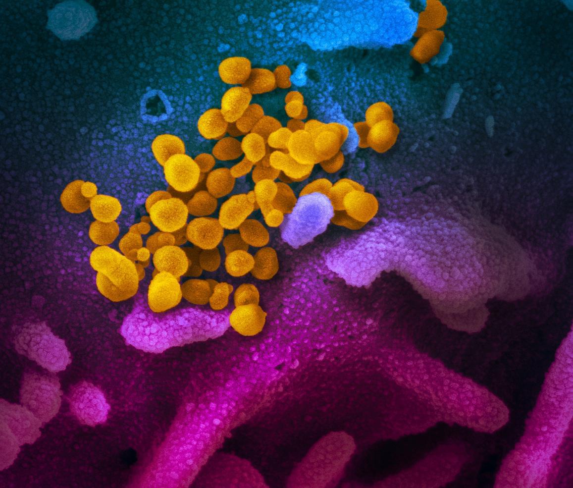 Tarrant County Dog the First in Texas to Test Positive for Virus that Causes COVID-19