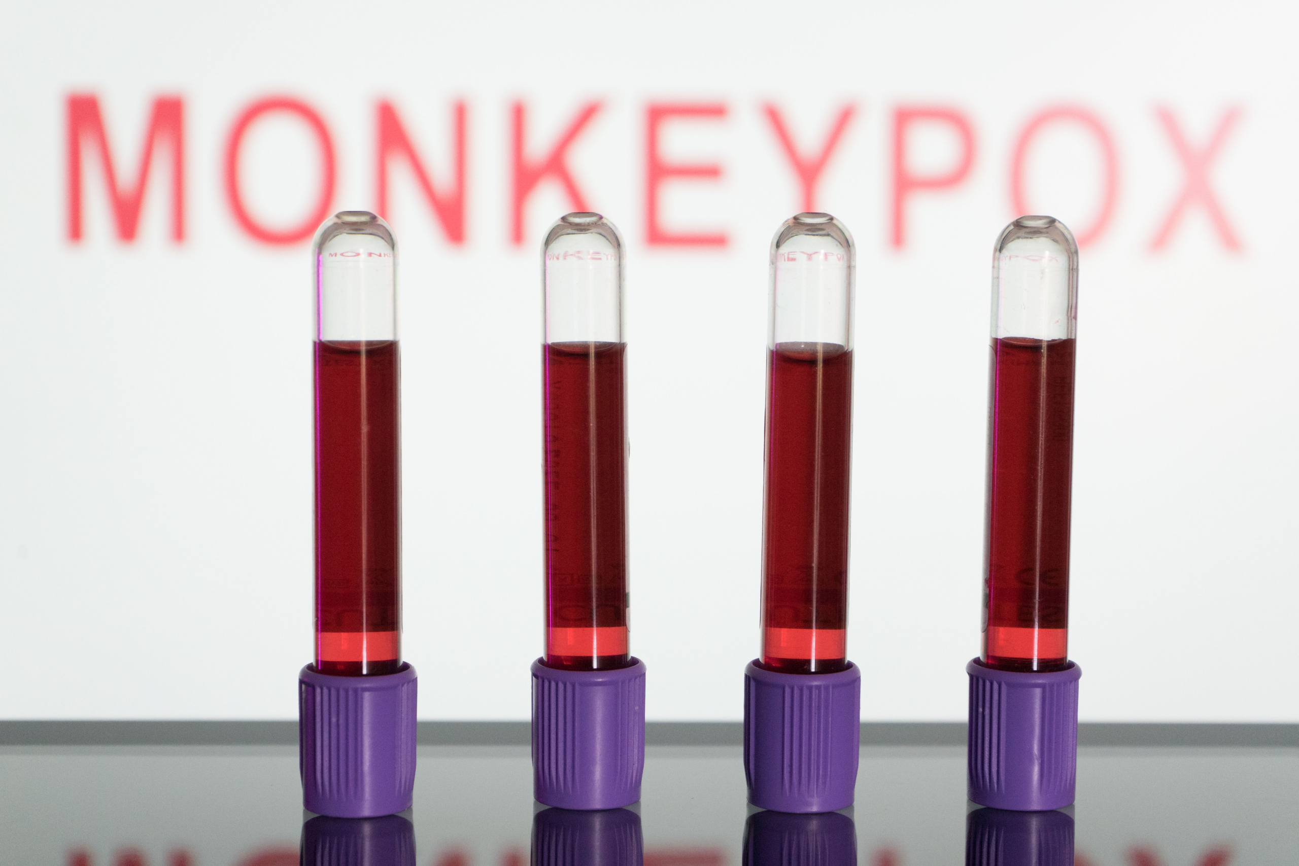 Tarrant County: Health Officials Investigating First Case of Monkeypox