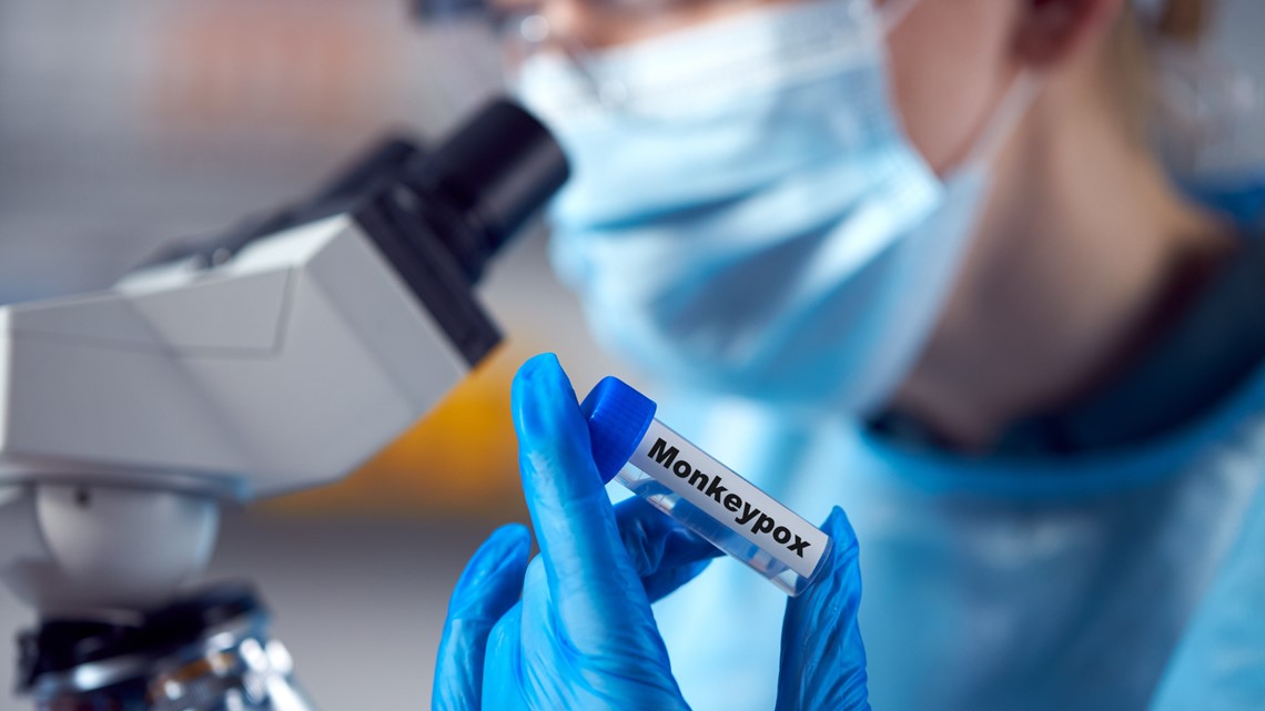 40% of Texas Monkeypox Cases are in NTX