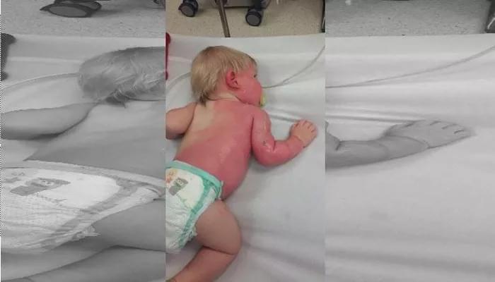 Don’t Burn Your Kids: Run The Garden Hose First