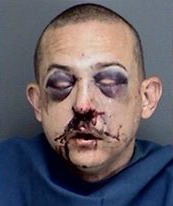 Man Takes Care Of Alleged Knife Wielding Neighbor