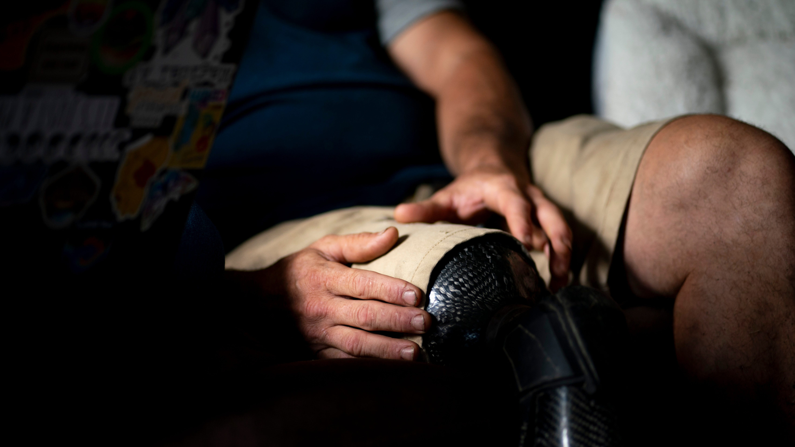 Chicago man finds prosthetics in Uptown, trying to reunite them with owner