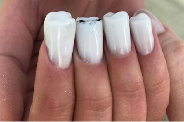 The Molar Nails Are The Scary New Trend