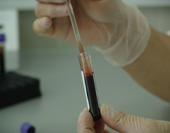 New 'Superbug' Fungus is Resistant to Drugs found in Chicago and other U.S. Cities