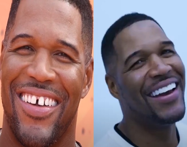 Michael Strahan Gets Rid Of His Famous Tooth Gap [VIDEO]