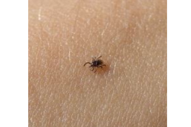 CDC warns tick-borne illnesses are on the rise