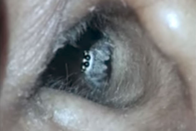 Woman’s Headache Caused by Spider Living In Her Ear [VIDEO]