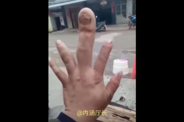 Why is This Guy’s Middle Finger So Big? [VIDEO]