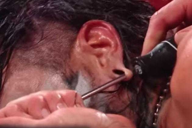 Watch Randy Orton Twist Jeff Hardy’s Ear with a Screwdriver at Hell in a Cell [VIDEO]