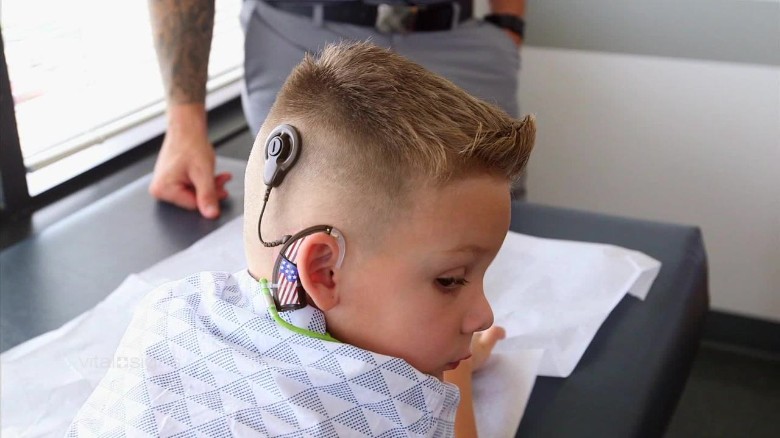 Next generation hearing implants for kids