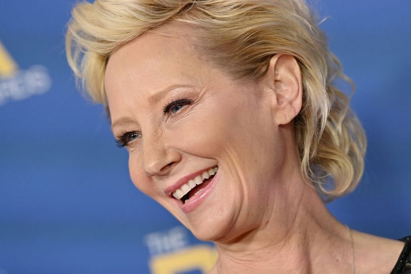 Anne Heche has passed away