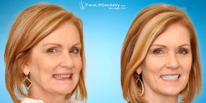 Facelift Dentistry is rethinking the way we fix our teeth