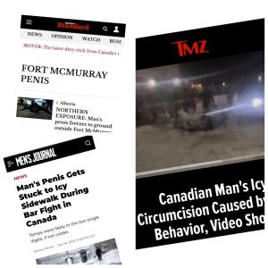 Frostbitten Fiasco: Fort McMurray Man Goes Viral After Sticky Situation